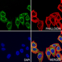 3 - Anti-ZNT8 Antibody AP61014