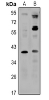 1 - Anti-ZNT8 Antibody AP61014