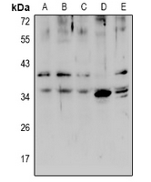 1 - Anti-ZIP1 Antibody AP61015