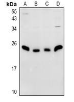 1 - Anti-N4WBP5 Antibody AP61017