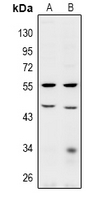 1 - Anti-BRE Antibody AP61018