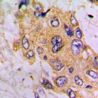 19 - Anti-GNE Antibody AP61020