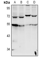 1 - Anti-Cytochrome P450 20A1 Antibody AP61026