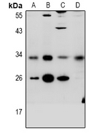 1 - Anti-CD272 Antibody AP61027