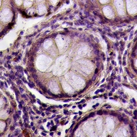 19 - Anti-Desmoglein 1 Antibody AP61028
