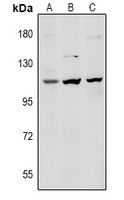 1 - Anti-Desmoglein 1 Antibody AP61028