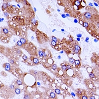 19 - Anti-Cathepsin L Antibody AP61031