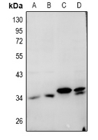 1 - Anti-Cathepsin L Antibody AP61031