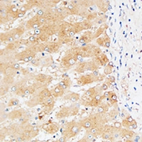 19 - Anti-Factor II Antibody AP61033