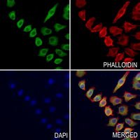 3 - Anti-Hepassocin Antibody AP61034