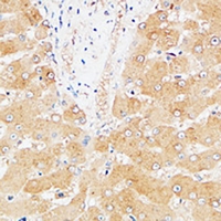 19 - Anti-Hepassocin Antibody AP61034