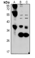 1 - Anti-Hepassocin Antibody AP61034
