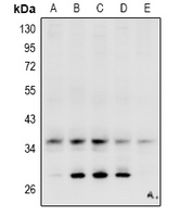 1 - Anti-Carbonic Anhydrase 4 Antibody AP61035
