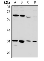 1 - Anti-CD32b Antibody AP61036