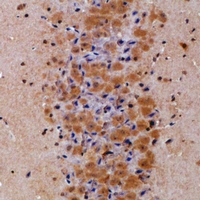 19 - Anti-Prolyl Endopeptidase Antibody AP61037