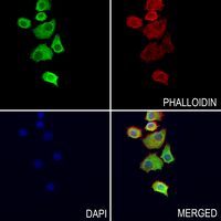 3 - Anti-Myeloperoxidase 89k Antibody AP61038