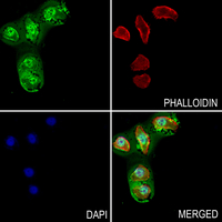3 - Anti-Acrosin Antibody AP61039