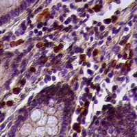 19 - Anti-Acrosin Antibody AP61039