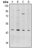1 - Anti-Acrosin Antibody AP61039
