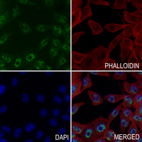3 - Anti-ADAM10 Antibody AP61040