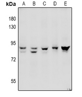 1 - Anti-ADAM10 Antibody AP61040