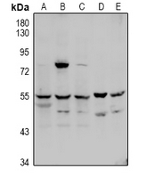 1 - Anti-Factor X LC Antibody AP61042
