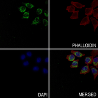 3 - Anti-Complement C1R HC Antibody AP61043