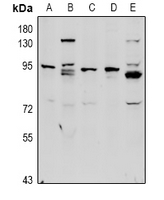 1 - Anti-Complement C1R HC Antibody AP61043