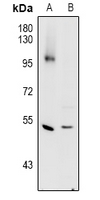 1 - Anti-Cathepsin C HC Antibody AP61044