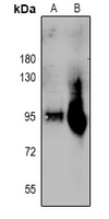 1 - Anti-Plasminogen HC A Antibody AP61045