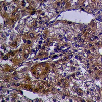 19 - Anti-GPR124 Antibody AP61047