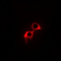 3 - Anti-GPR169 Antibody AP61050