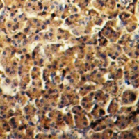 19 - Anti-Amphiphysin 2 Antibody AP61052