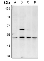 1 - Anti-Amphiphysin 2 Antibody AP61052