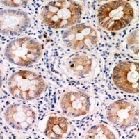 19 - Anti-PDGFC Antibody AP61053
