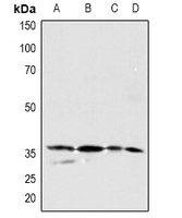 1 - Anti-PDGFC Antibody AP61053