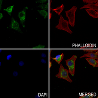 3 - Anti-HMB45 Antibody AP61056