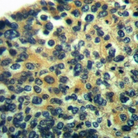19 - Anti-HMB45 Antibody AP61056