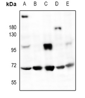1 - Anti-HMB45 Antibody AP61056