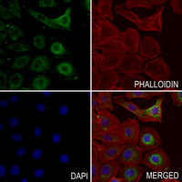 3 - Anti-P5CS Antibody AP61058
