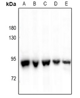 1 - Anti-P5CS Antibody AP61058