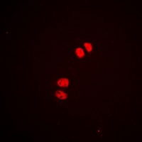 3 - Anti-MEF2A (Phospho-S408) Antibody AP61059