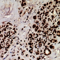 19 - Anti-MEF2A (Phospho-S408) Antibody AP61059