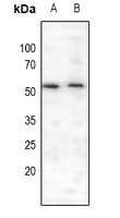 1 - Anti-MEF2A (Phospho-S408) Antibody AP61059