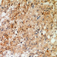19 - Anti-Synaptotagmin (Phospho-T202/199) Antibody AP61060