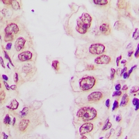 19 - Anti-C/EBP alpha (Phospho-S21) Antibody AP61061