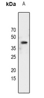 1 - Anti-C/EBP alpha (Phospho-S21) Antibody AP61061