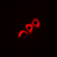 3 - Anti-CRK (Phospho-Y221) Antibody AP61062