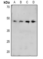 1 - Anti-CRK (Phospho-Y221) Antibody AP61062