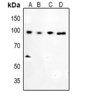 1 - Anti-Glucocorticoid Receptor (Phospho-S226) Antibody AP61063
